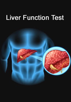 Liver Function Test (LFT)