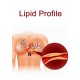 Lipid Profile